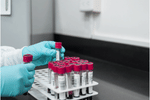 CUET PG Forensic Science 2025 Expected Marks vs Rank Analysis