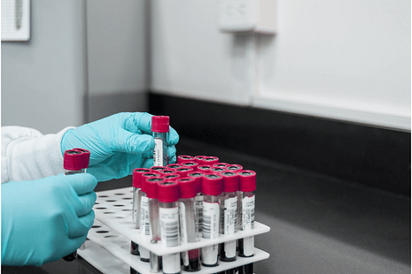 CUET PG Forensic Science 2025 Expected Marks vs Rank Analysis