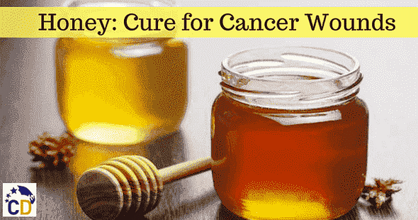 Honey is Good to Treat Oral Cancer Wounds: IIT Kharagpur Study