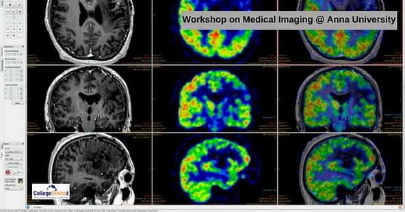 Anna University to Organize Short-Term course on Medical Imaging Techniques